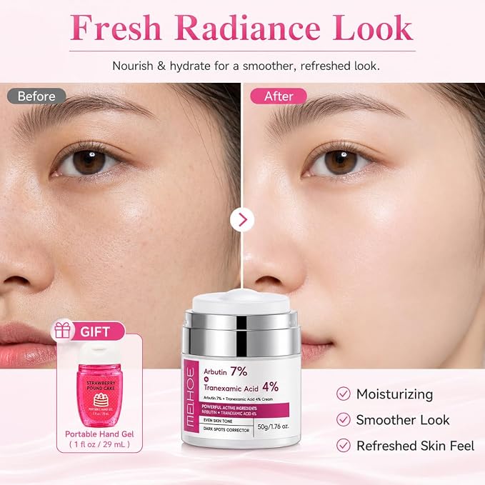 Arbutin 7% + Tranexamic Acid 4% Face Cream