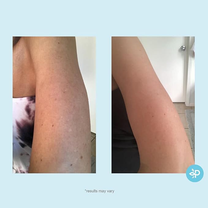 10% Strength Peel