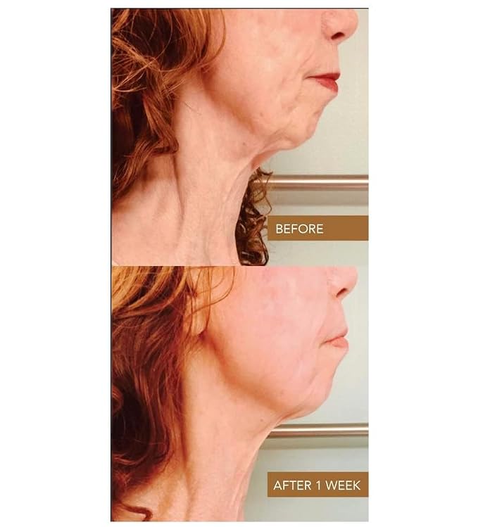 __DEFAULT__