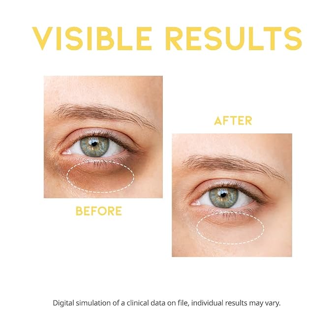 Vitamin C Dark Circle Serum