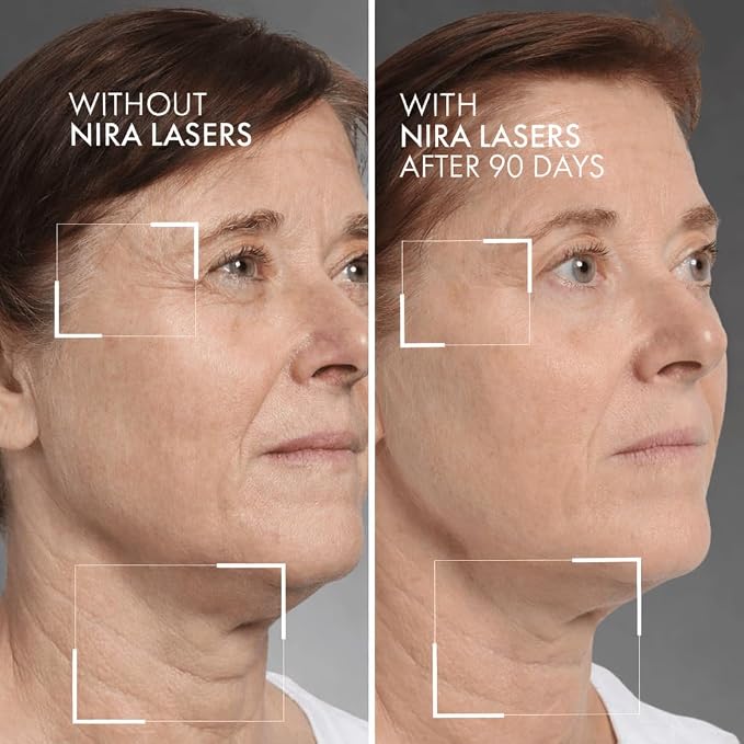 White - Large Area Laser