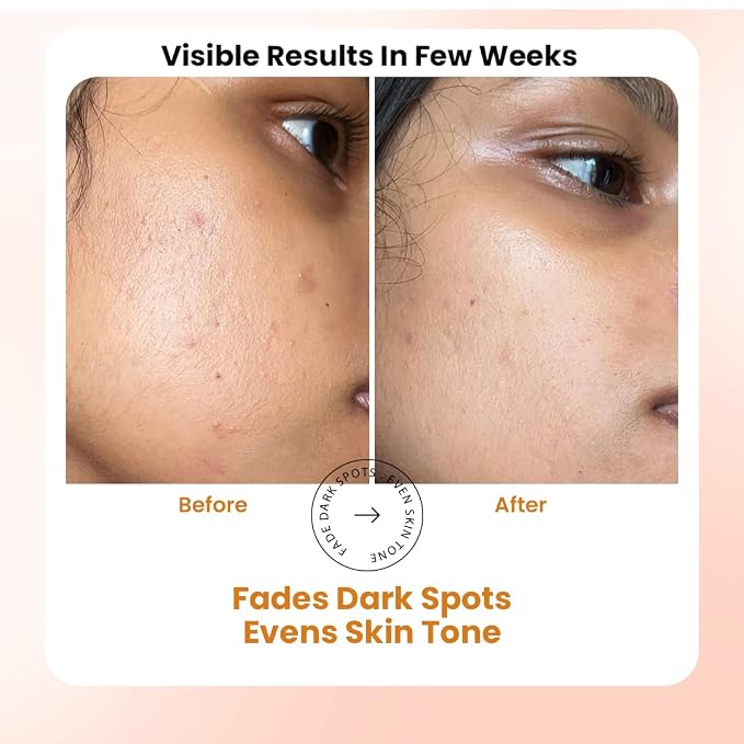 Advance C Radiance Serum