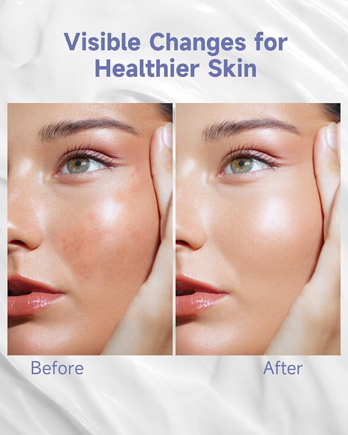Facial Moisturizing Lotion