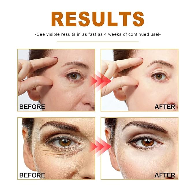 7pcs