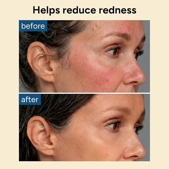 Hydro Soothe