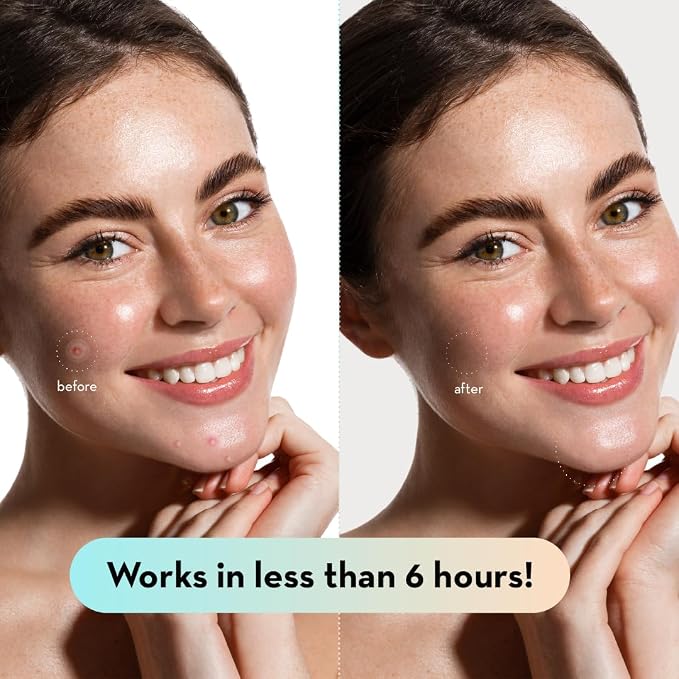__DEFAULT__