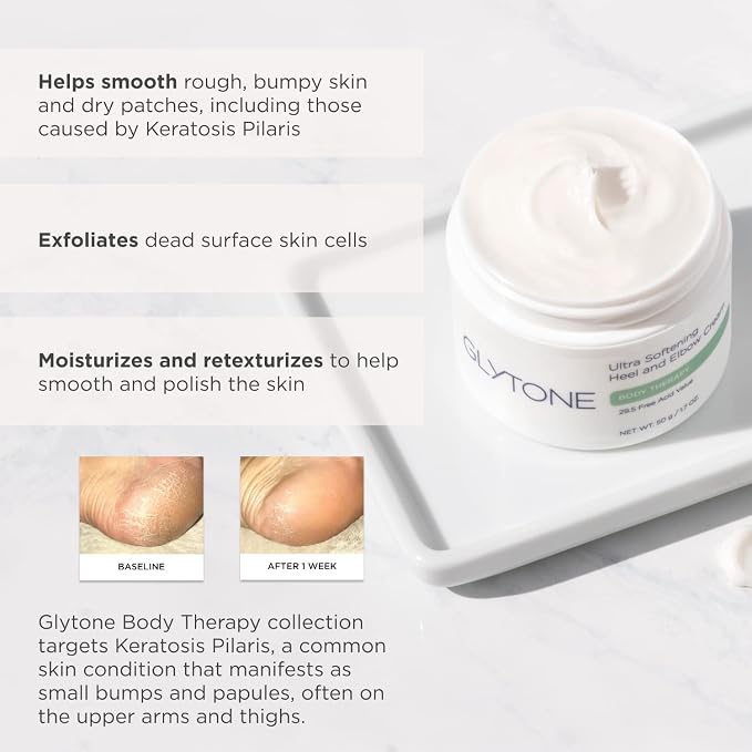Heel and Elbow cream