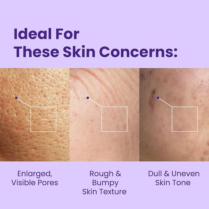 Retinol Vitamin