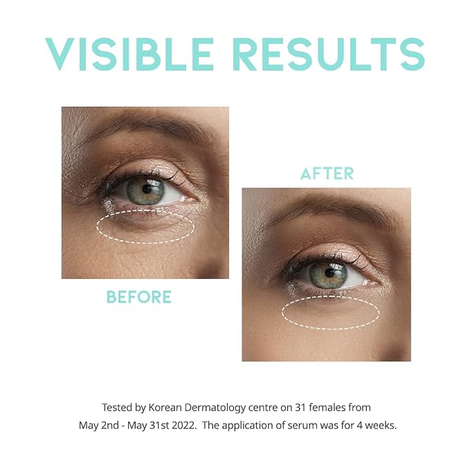 Retinol Wrinkle Lift Serum