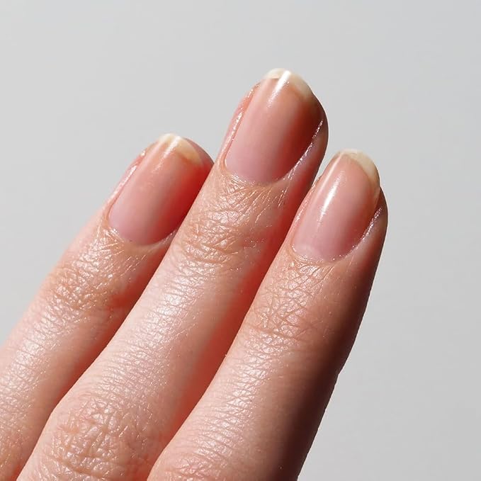 Nail Recovery Treatment
