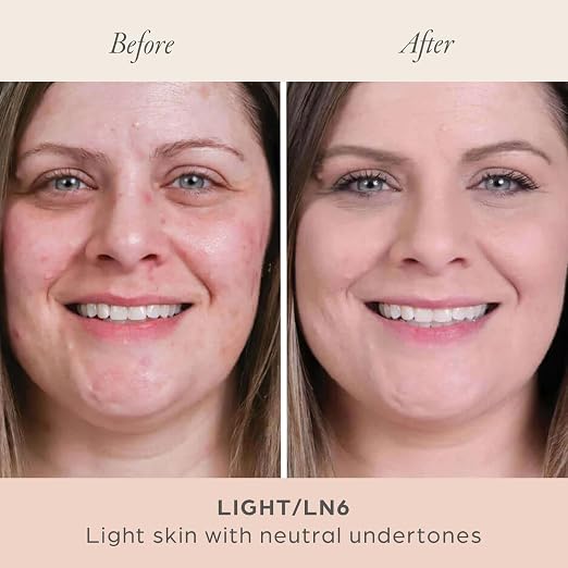 Light/LN6 - light skin with neutral undertones