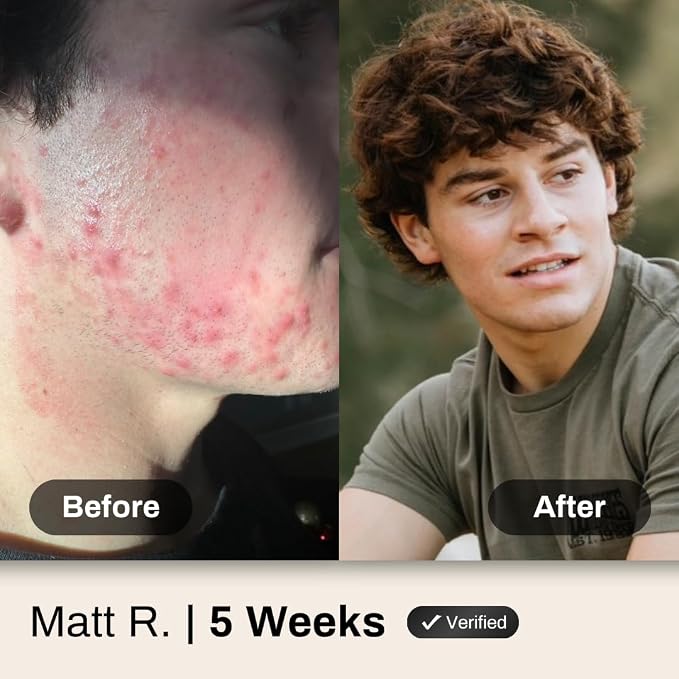 __DEFAULT__