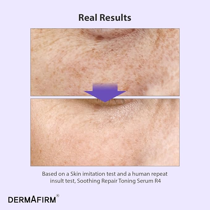 Soothing Repair Serum R4