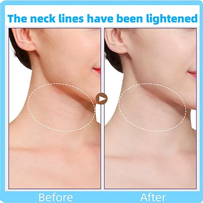 neck lift tape (4 strips+20 patches )-C