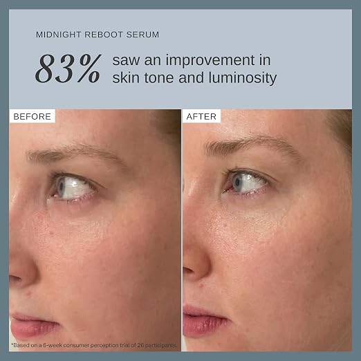 __DEFAULT__