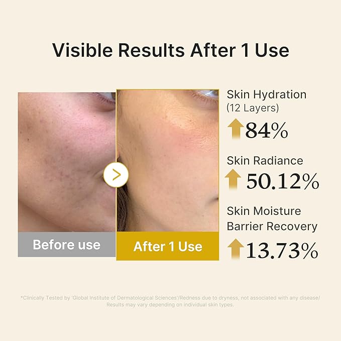 Kojic Acid Turmeric