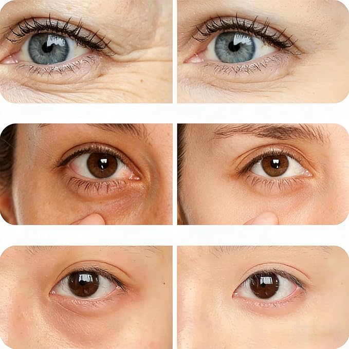 1 PC Eye Pods