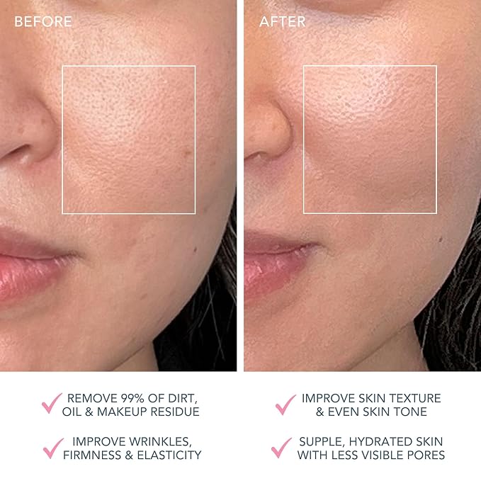 Normal Skin