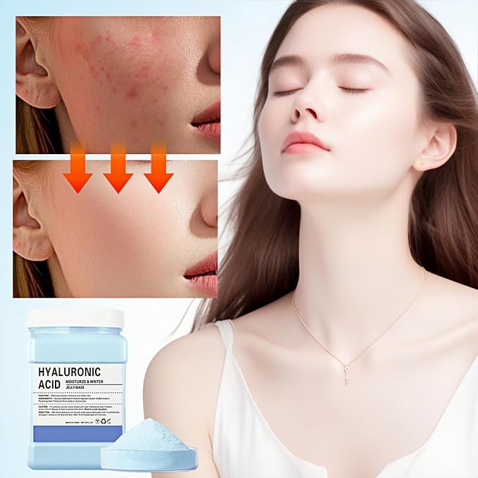 Hyaluronic Acid