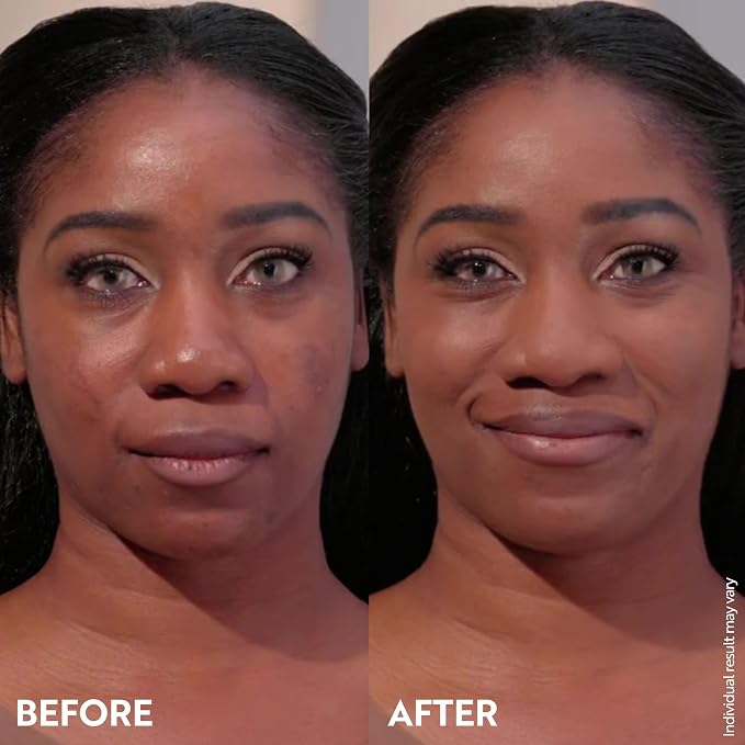 Deeper skin tones