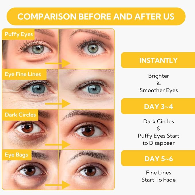 Gold-Fine Lines Reduce