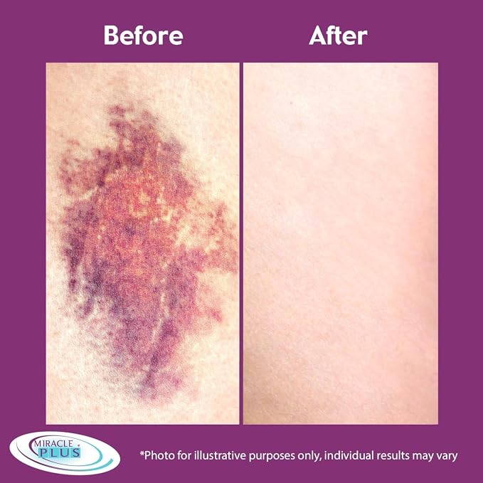 Arnica Bruise Cream