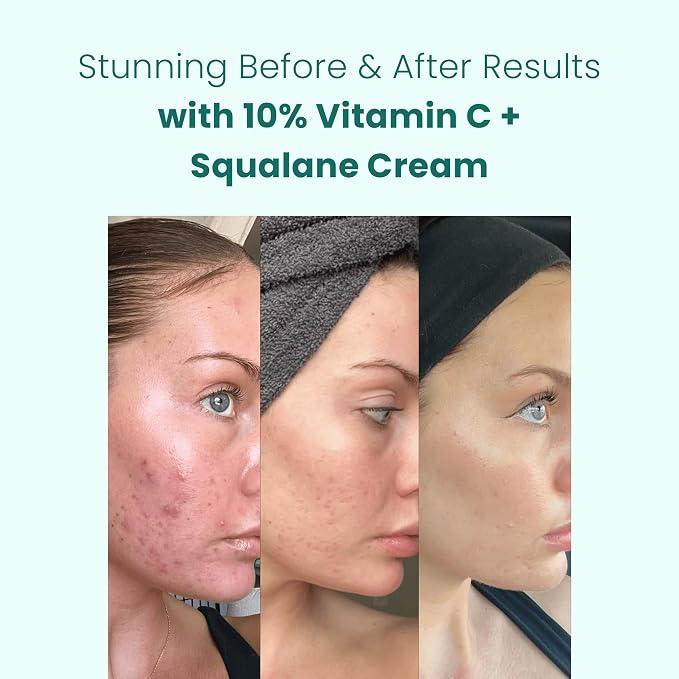 Vitamin C 10%