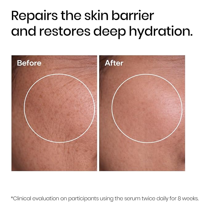 LIPID BOOSTER-30 Ml