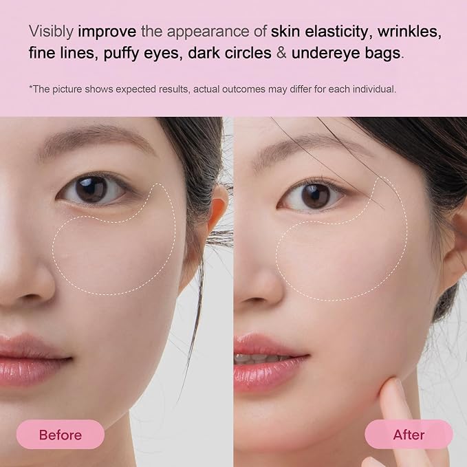 Collagen