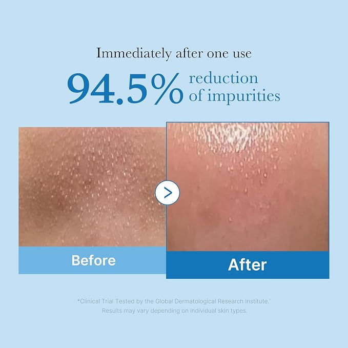 Zero Pore