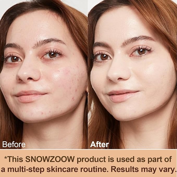 Light spectrum -Gold Lid- suitable for people with fair skin