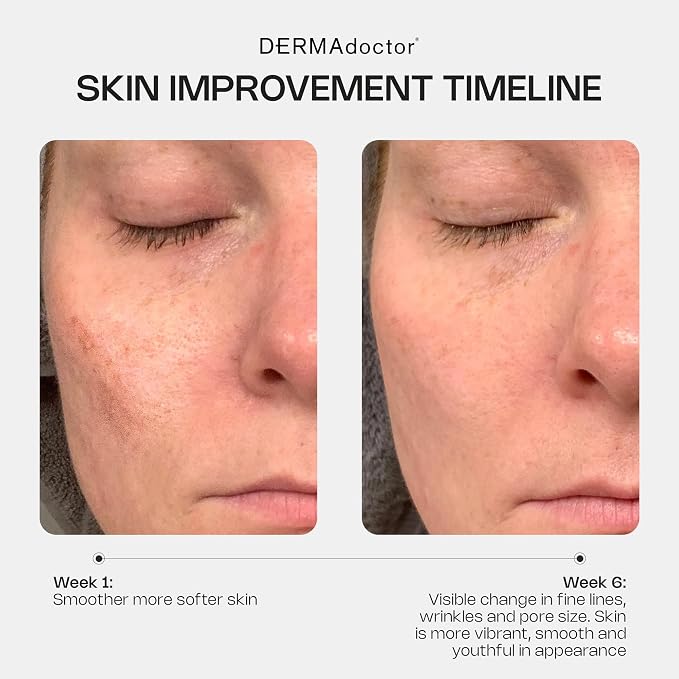 Retinol Face Cream