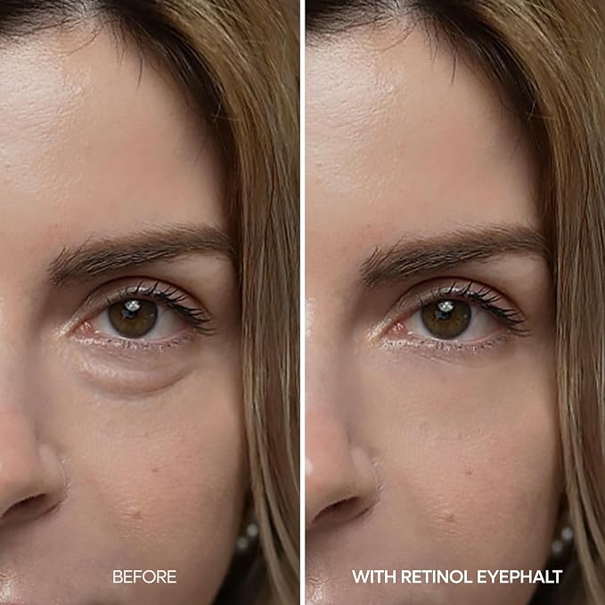 Retinol