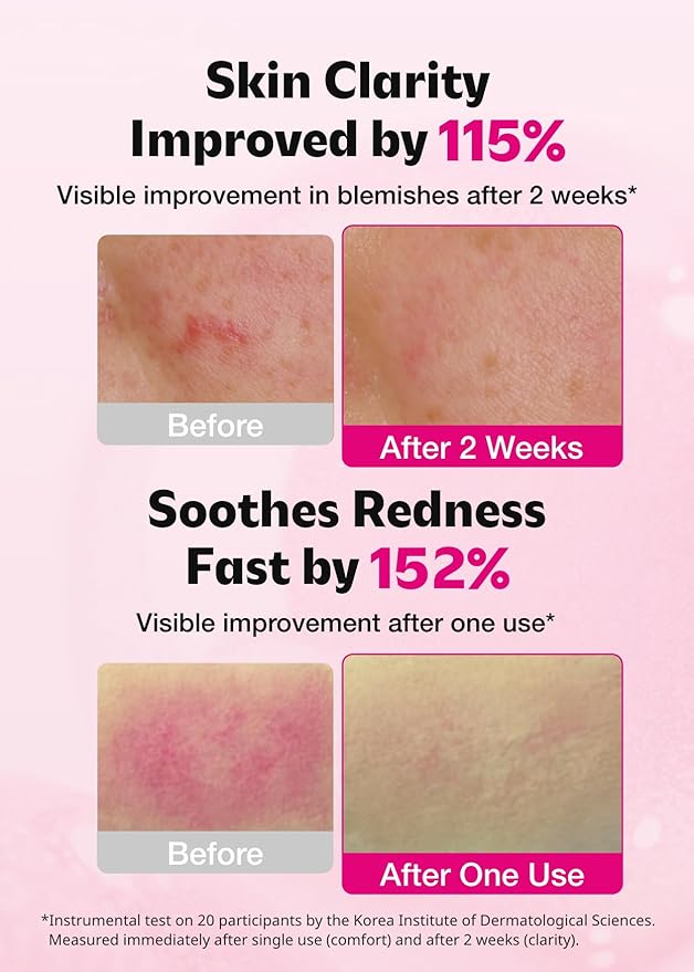 Blemish Care