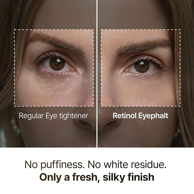 Retinol