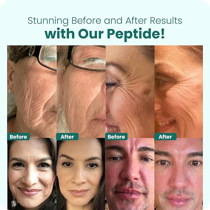 Peptide