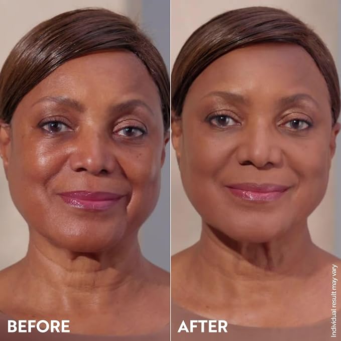 Deeper skin tones
