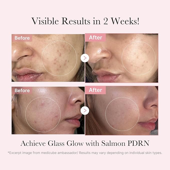 PDRN Glow Kit