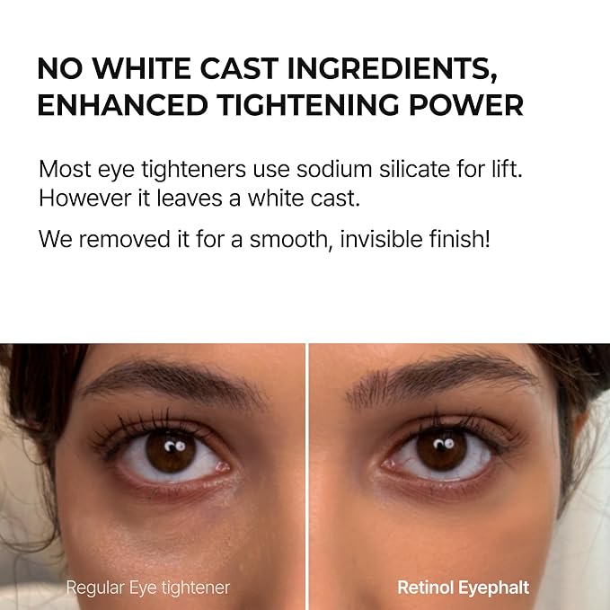 Retinol