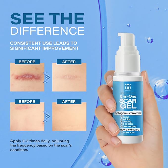 Scar Cream