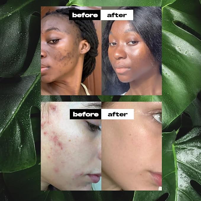 African black soap