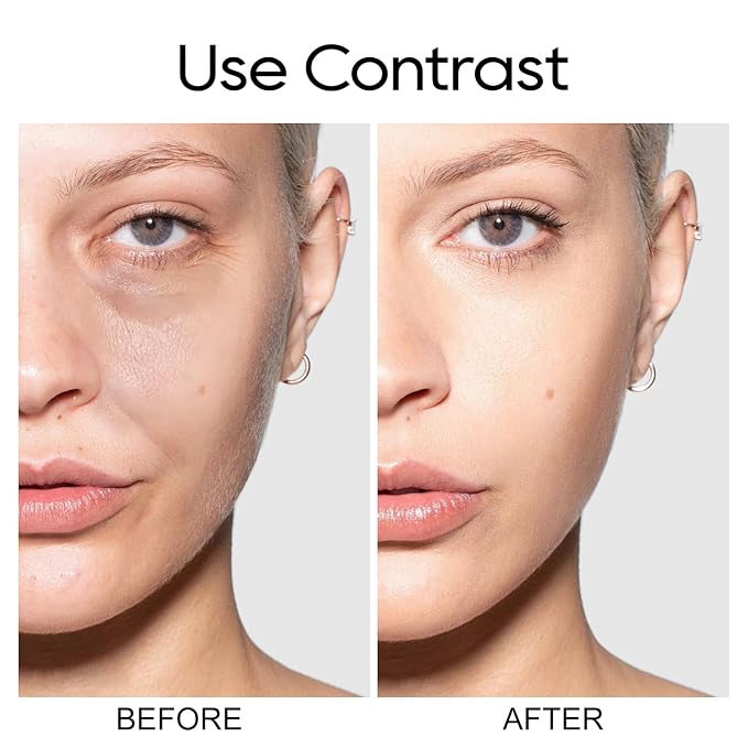 Hyaluronic Acid