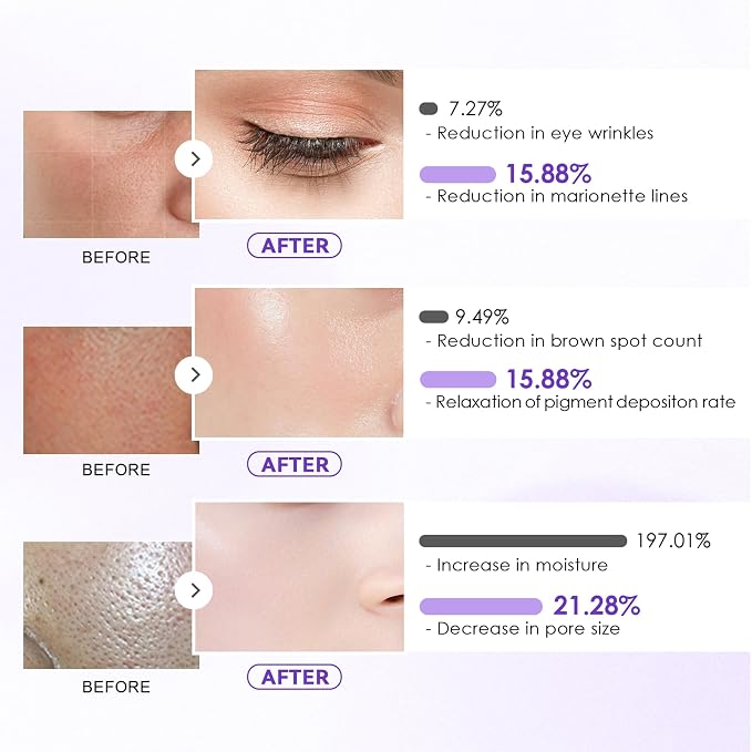 17 Pcs