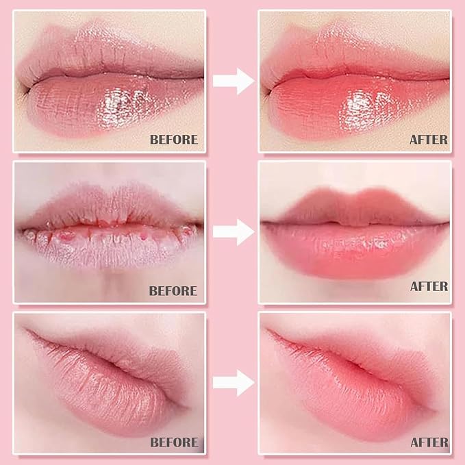 Honey & Strawberry & Watermelon & Apple Lime & Cherry & Mint