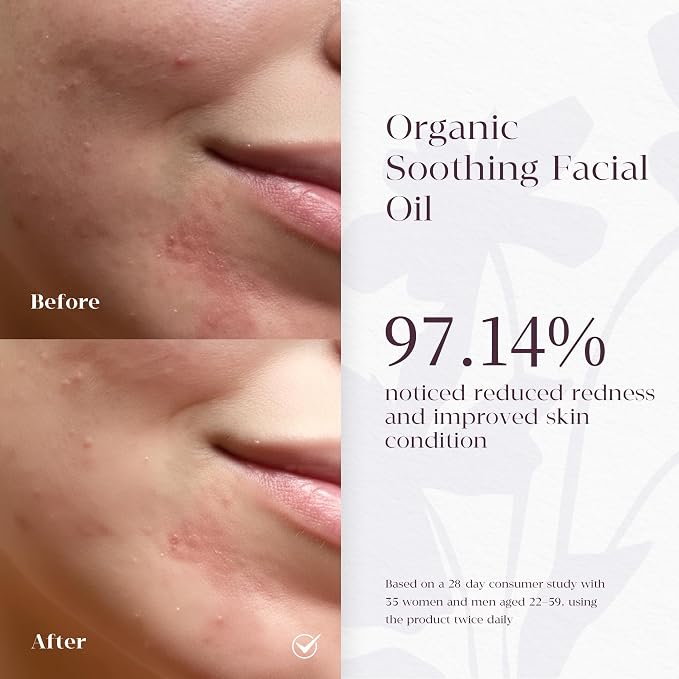 Barrier Repair Face Serum