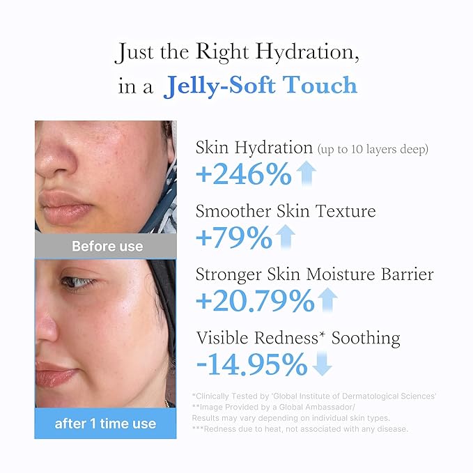 Hyaluronic Acid
