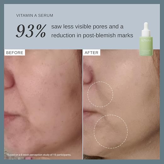 Vitamin A: Anti-Aging