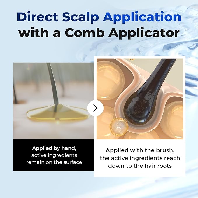Full Scalp Care