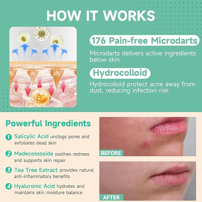 72P Microdart Pimple Patches
