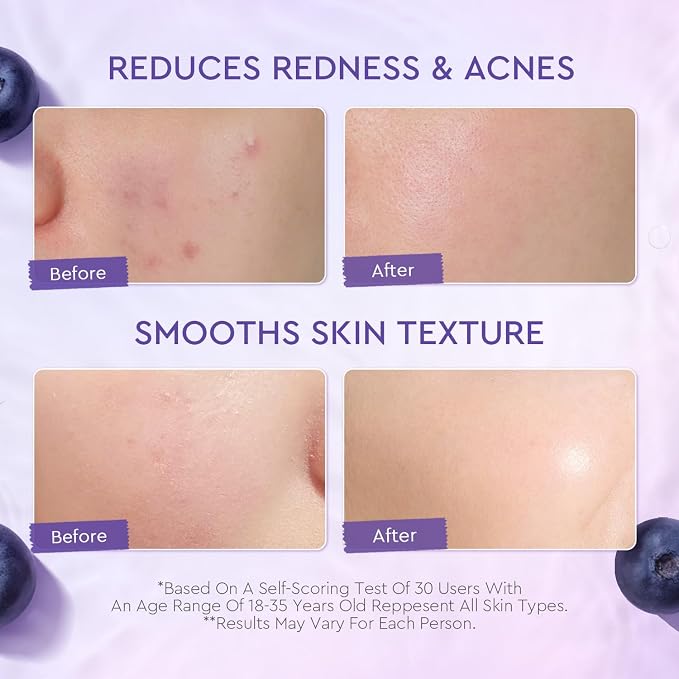 BLUEBERRY CERAMIDE BARRIER